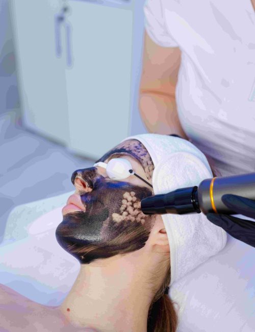 laser-carbon-peeling-facial-with-professional-skin-2025-08-02-03-48-43-utc